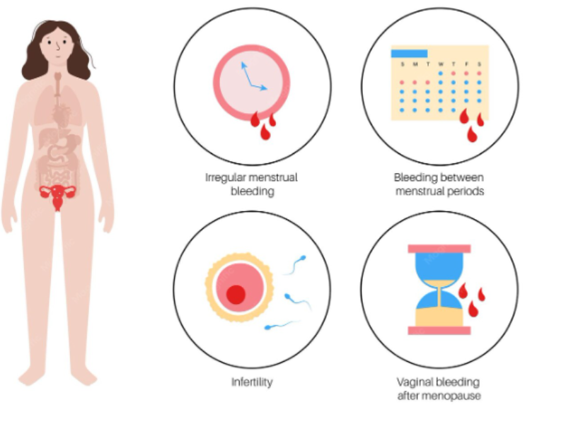 Menstrual disorders treatment and gynecological care in Kanpur